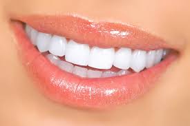 Teeth Whitening