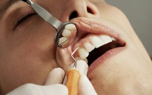 Dental exam with mirror and probe during a routine checkup