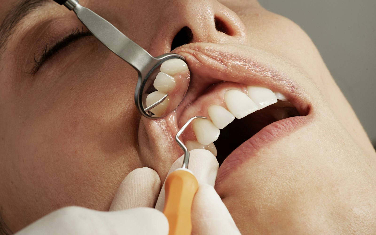 Dental exam with mirror and probe during a routine checkup