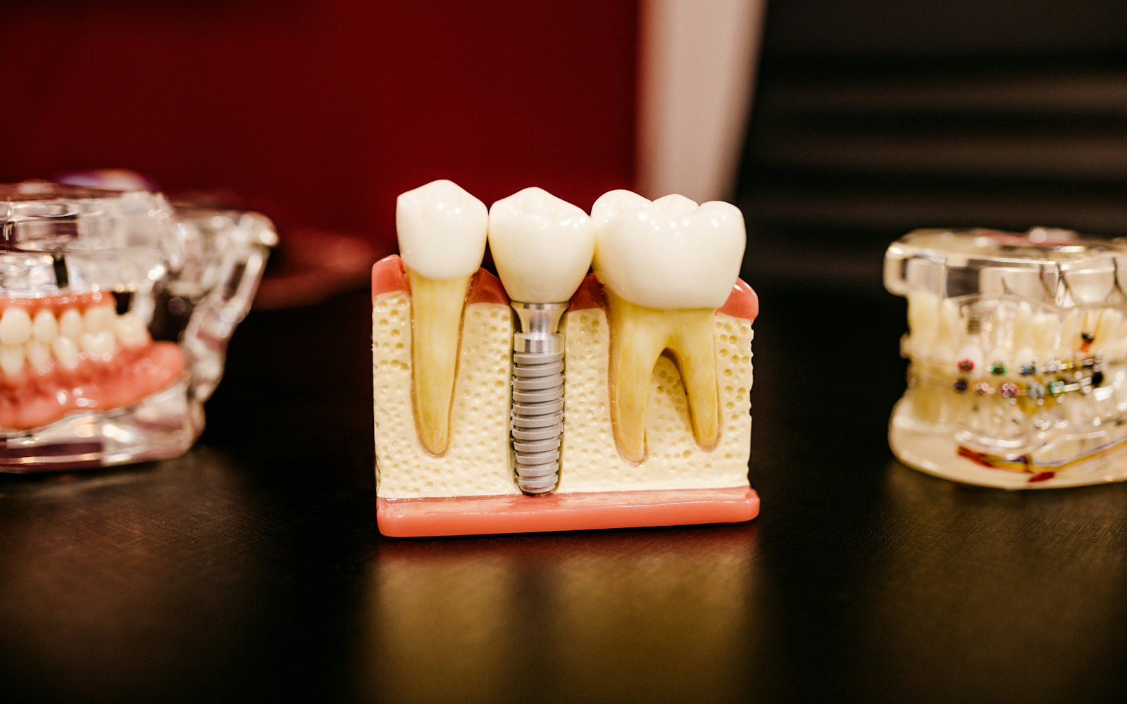 Dental implant model next to natural-looking teeth