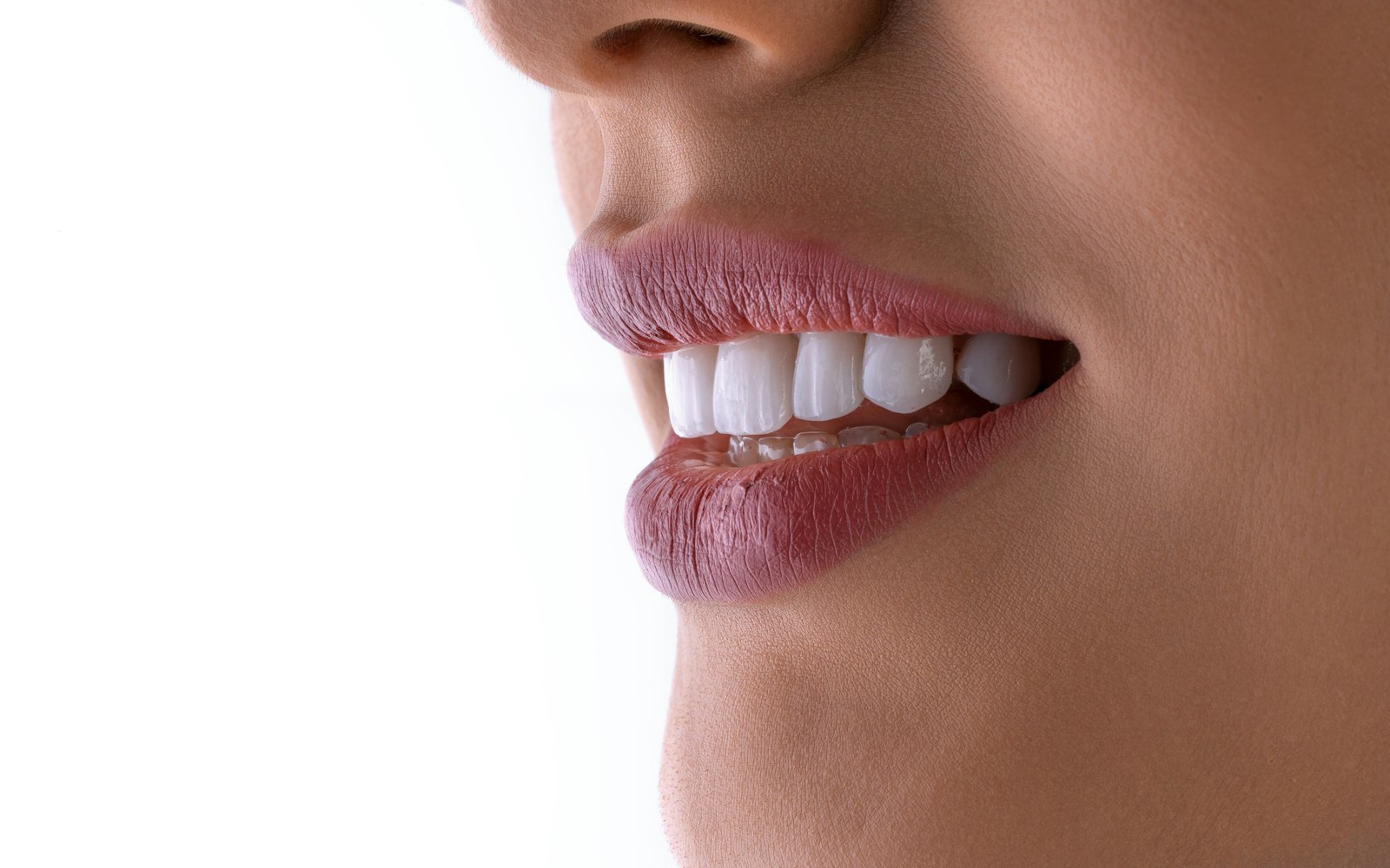 Close-up of a bright white smile after professional teeth whitening