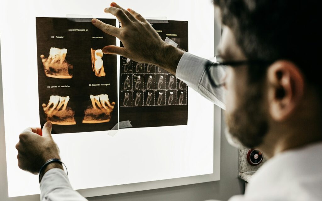 Dentist reviewing dental X-ray scans to diagnose a tooth infection
